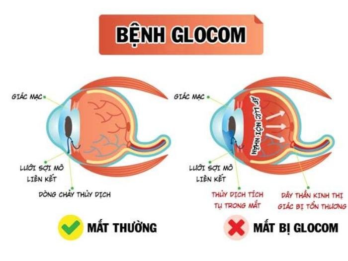 Liên kết