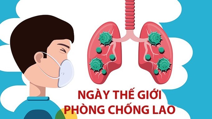 Liên kết
